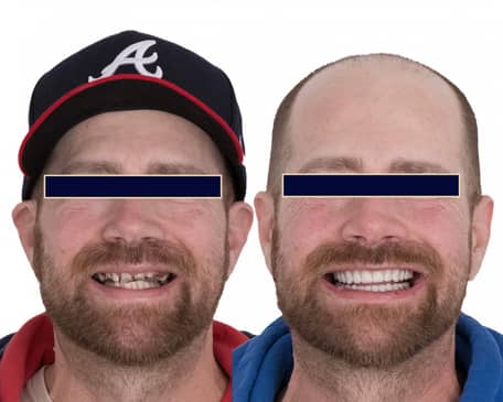 Slider image (4) The Dental Corner